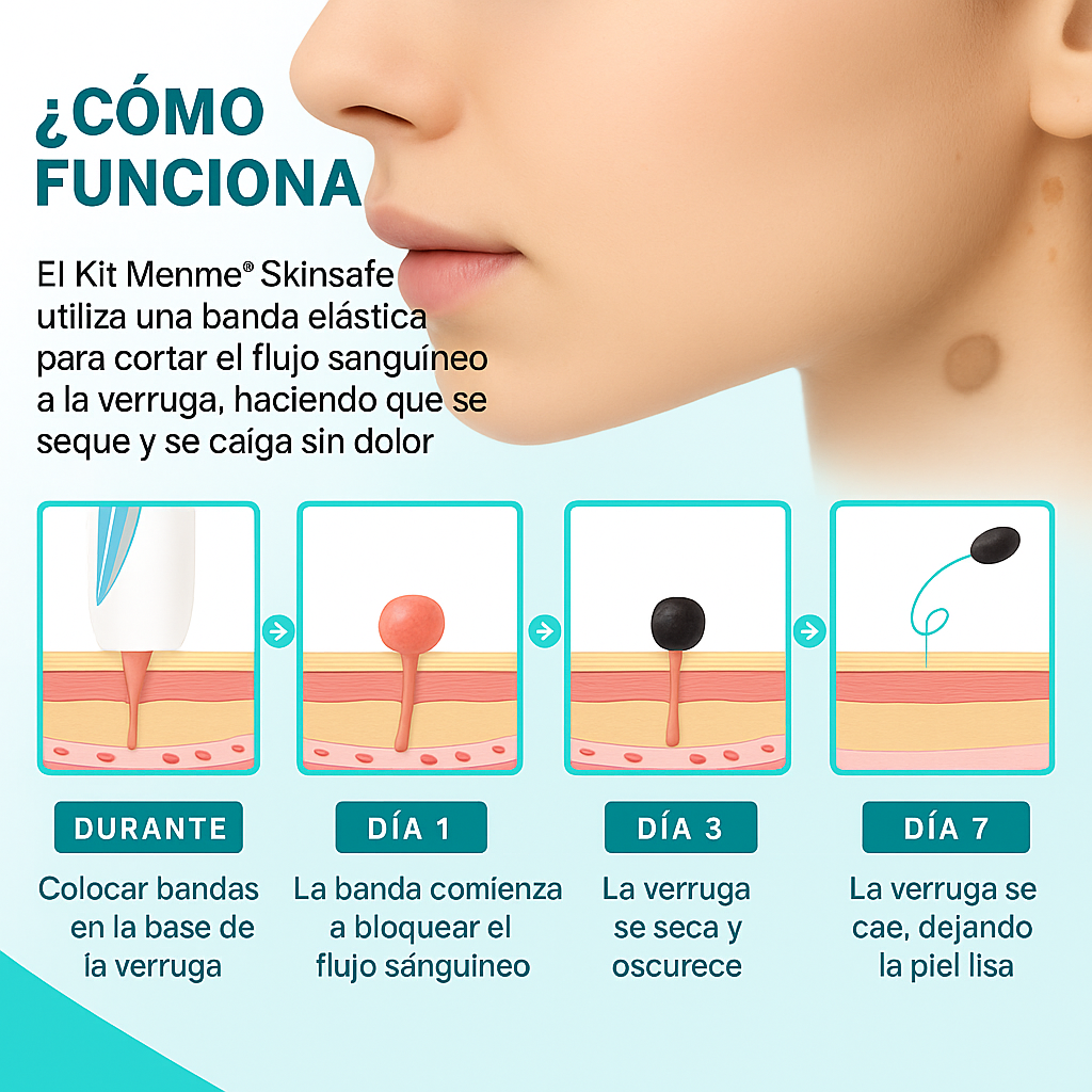 TagPal™ – Elimina Verrugas de Forma Segura y sin Dolor en Casa
