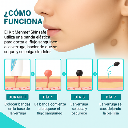 TagPal™ – Elimina Verrugas de Forma Segura y sin Dolor en Casa